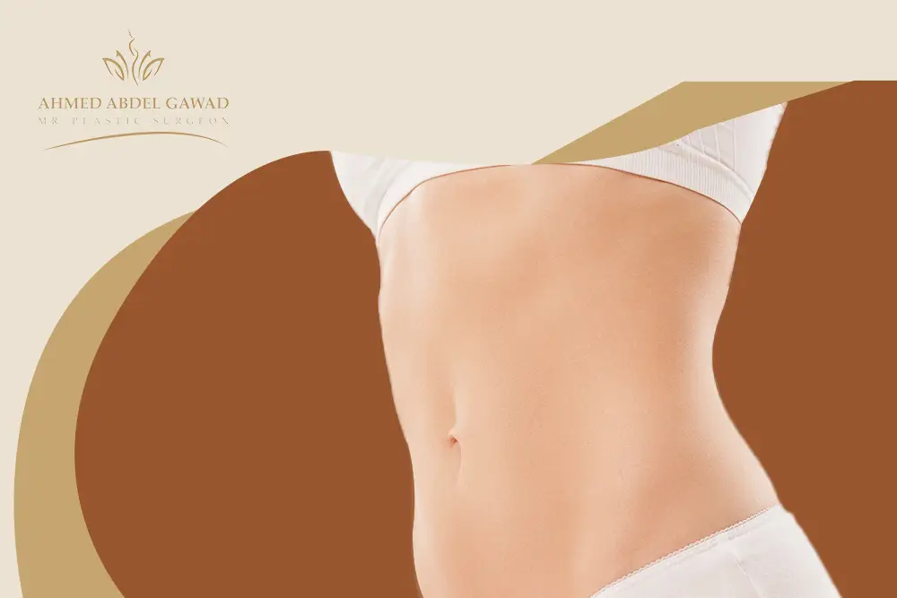 عملية شد عضلات البطن