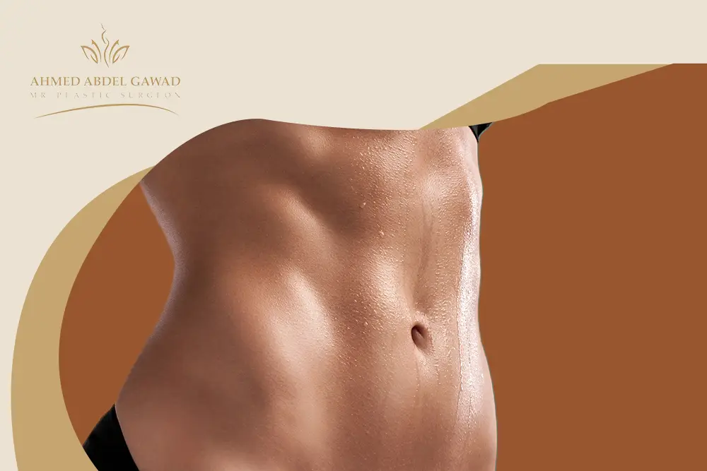 عملية نحت البطن