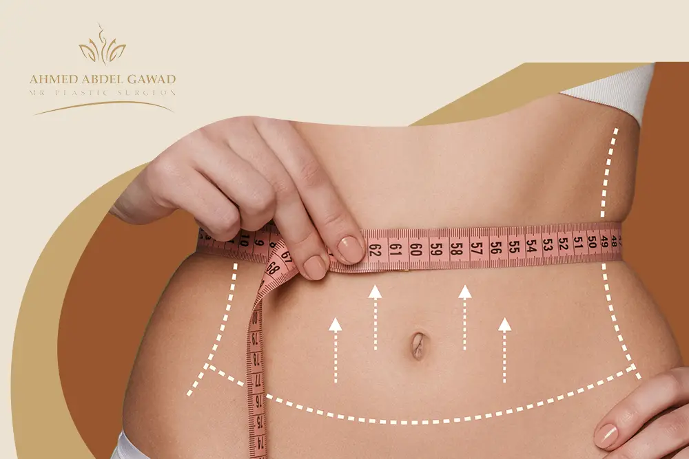 عملية شد البطن بالصور