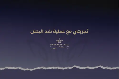 تجربتي مع عملية شد البطن