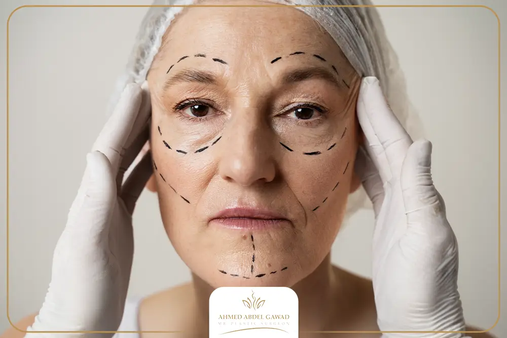 تجربتي مع عملية شد الوجه