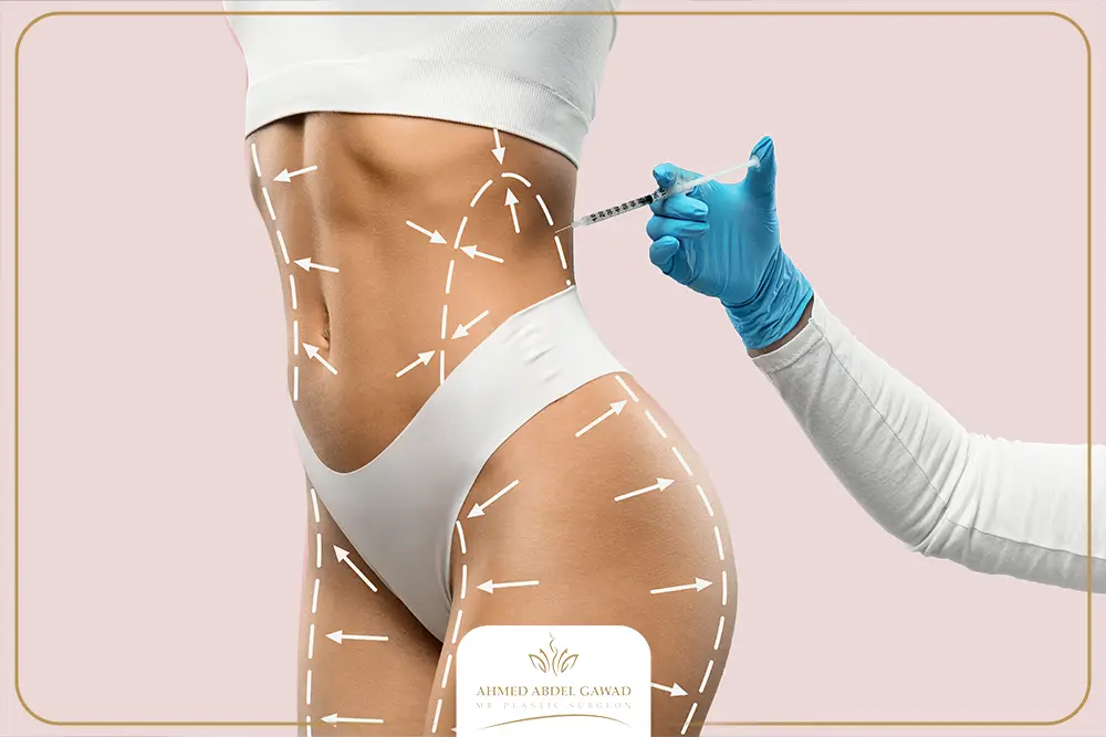 تجربتي مع عملية نحت الجسم