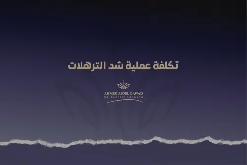 تكلفة عملية شد الترهلات