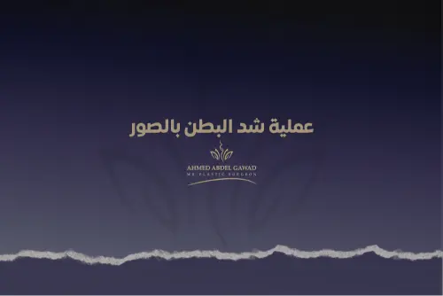 عملية شد البطن بالصور