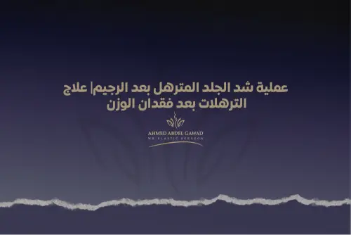 عملية شد الجلد المترهل بعد الرجيم