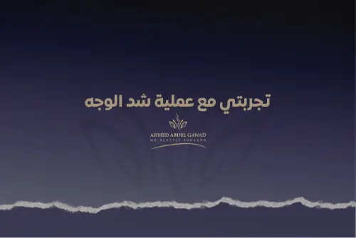 تجربتي مع عملية شد الوجه