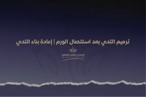 ترميم الثدي بعد استئصال الورم