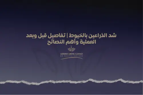 شد الذراعين بالخيوط