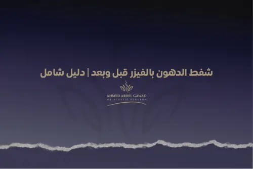 شفط الدهون بالفيزر قبل وبعد