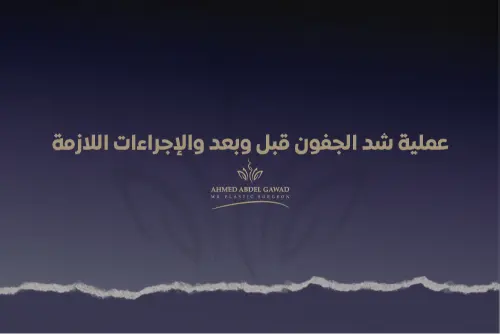 عملية شد الجفون قبل وبعد