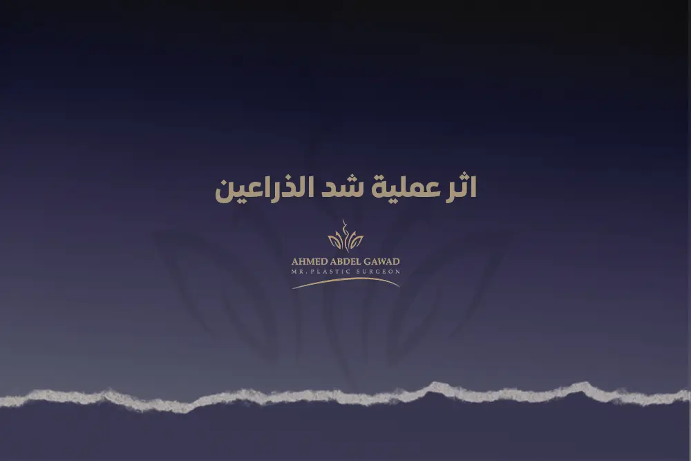 اثر عملية شد الذراعين