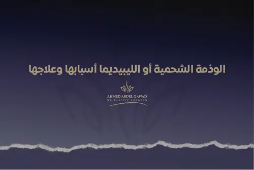 الوذمة الشحمية أو الليبيديما أسبابها وعلاجها