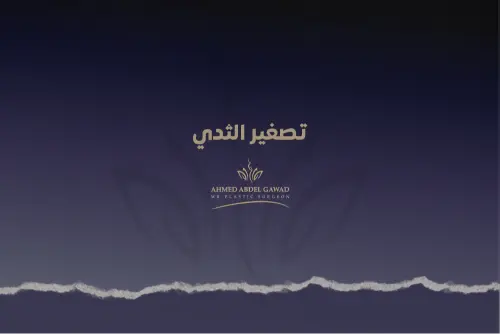 تصغير الثدي